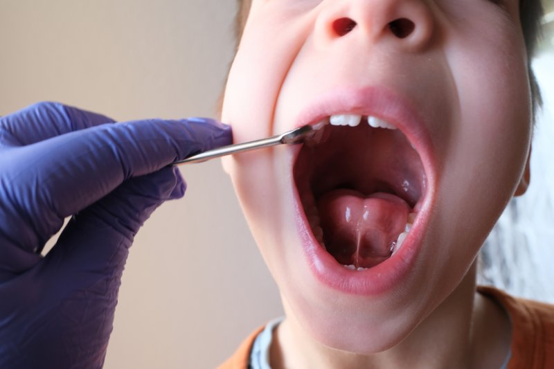 a child undergoing tongue-tie treatment